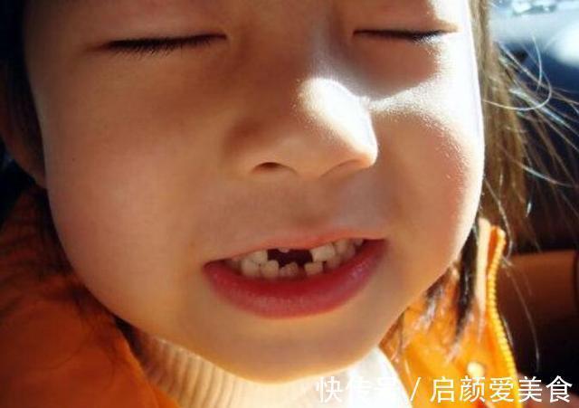 恒牙|儿童换牙顺序图:孩子几岁换?怎么换?一文说清