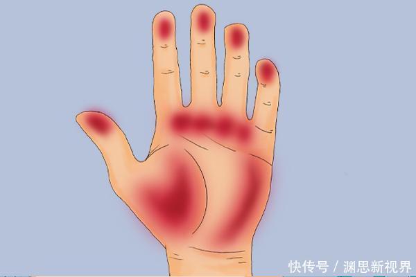 睡觉时,身体出现哪些怪象,多半是肝出事了尽