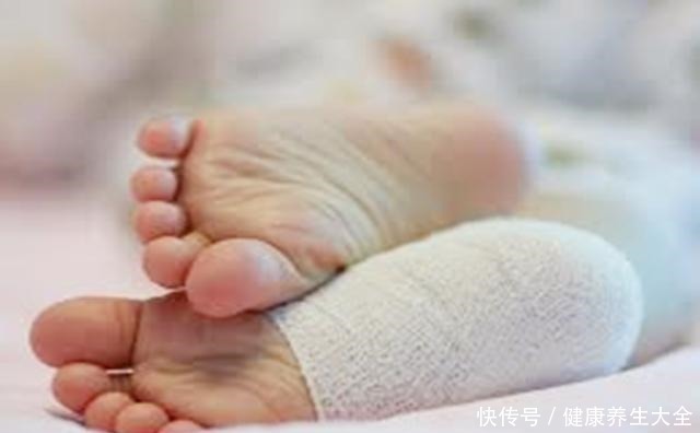 新潮|5岁女宝双脚变形,只因长期穿这鞋,选鞋“雷坑”很多妈妈还在犯!