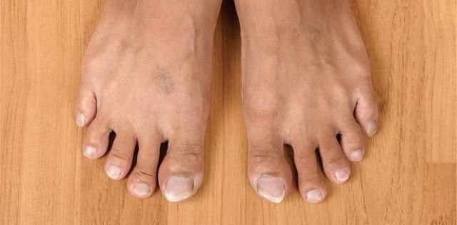 双腿|天然“溶栓剂”已揭晓,不是洋葱木耳,放肆吃,血管“畅通无阻”