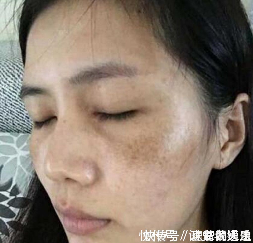 白嫩肌|色斑妹子别乱花钱了，用酸奶加它敷脸，美白嫩肤又淡斑，值得收藏