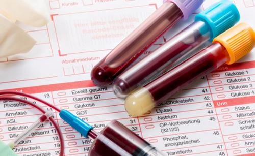 癌症|为什么动不动就要做血常规检查？做一次血常规，能查出什么？