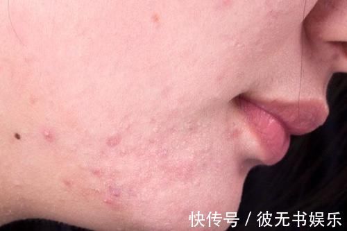 女性|损伤皮肤的行为,很多女性都在做,你一个都没占,或许皮肤很健康