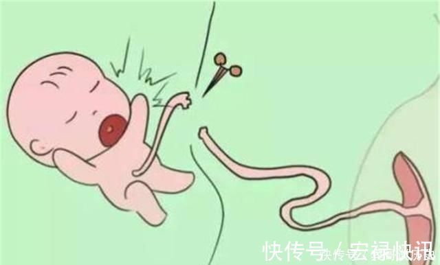 待产包|胎儿出生“剪脐带”时,是妈妈痛还是胎儿痛答案有点意外