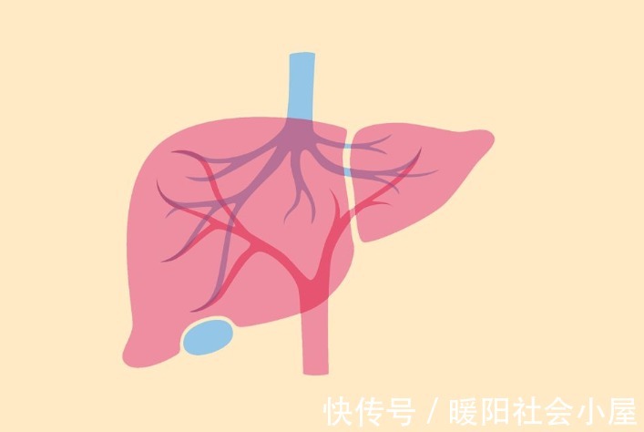 肝硬化|误认为皮肤过敏，结果查出“肝硬化”？皮肤3处异常别再不当回事