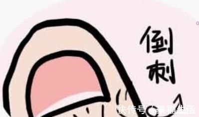 手指甲|纤纤玉手上为何会长倒刺,别再冤枉维生素,原因在这里