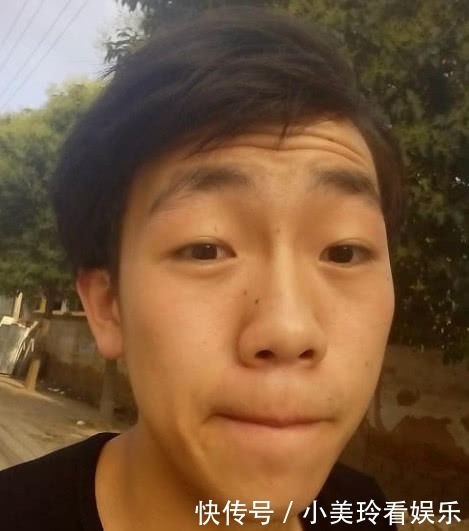 生活习惯|为什么会出现“抬头纹”？主要是这3大原因，别说你还不知道