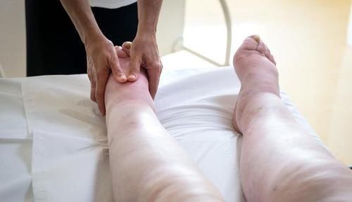  肾病综合征|肾病会“撒谎”：尿蛋白和水肿越重，反而病情越轻