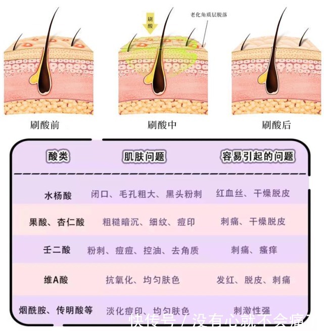 刺痛感|护肤品上脸后，皮肤刺痛真的是因为皮肤缺水吗？护肤必坑指南图解