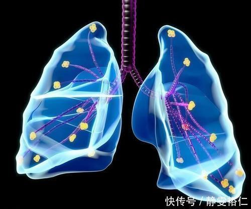 肺癌|远离肺癌,请记住:晨起3坚持、睡前3不宜,肺部会更健康