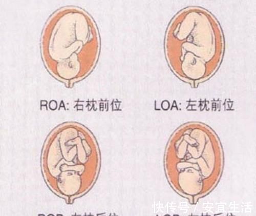 女性“臀宽腰圆”易顺产？旧经验不靠谱，这些才是影响顺产的因素