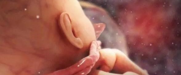 胎儿|为何会有脐带绕颈没有想象中那么可怕,做到4点让胎儿远离威胁