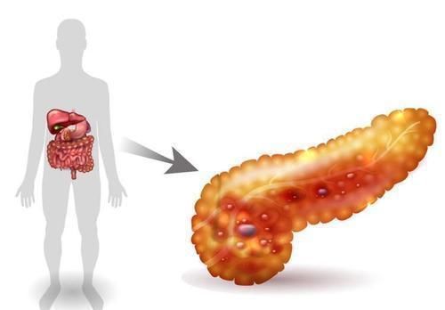 胆固醇|97岁王振义院士提醒:降血脂没有捷径,日常做好2件事,应牢记