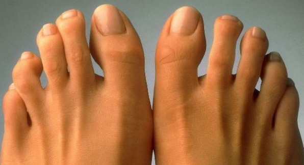 女人|女人“短命”,通常有3个特征,如果没有,说明比较健康