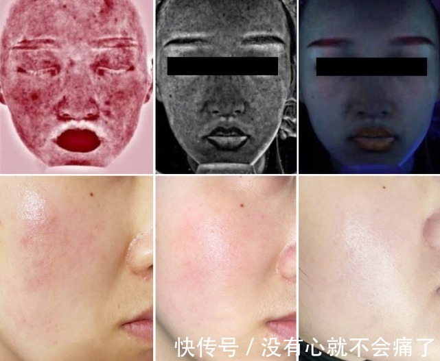 肤质|为什么天一热就皮肤敏感满脸通红?5招教你彻底告别大红脸!