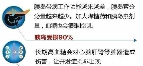 糖尿病|糖尿病人要多吃菜,多吃是指多少4种蔬菜“降糖王”不能错过