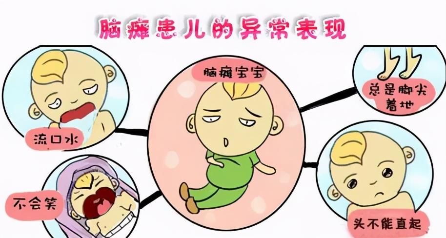 患儿|脑瘫患儿的几种症状表现，儿科医生：家长要提早认识并预防