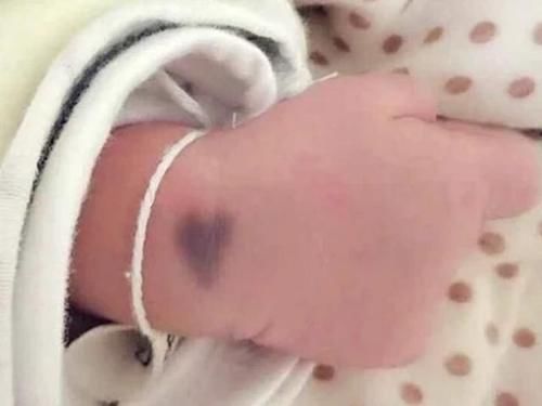 电器|女生怀孕后，4件事最好不做，避免宝宝身上会留下“胎记”