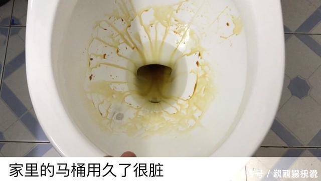 白醋|小苏打加白醋里太厉害了,好多人的难题全都解决了,看完抓紧试试