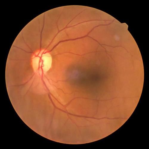 部位|很多人全身防晒，却漏掉了这个部位，后果多严重你知道吗？