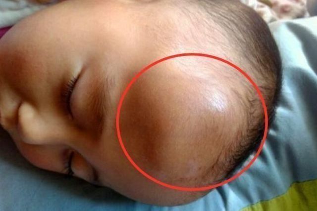 强强|1岁宝宝摔下床,妈妈的做法让婆婆直呼冷血,医生却说:做的对