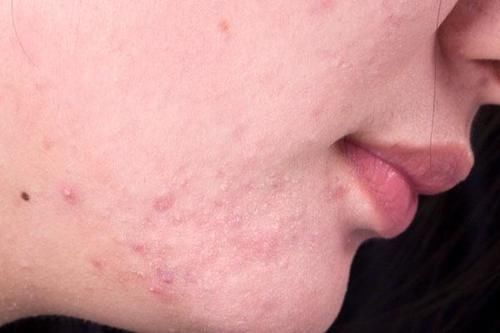 损伤皮肤的行为，很多女性都在做，你一个都没占，或许皮肤很健康