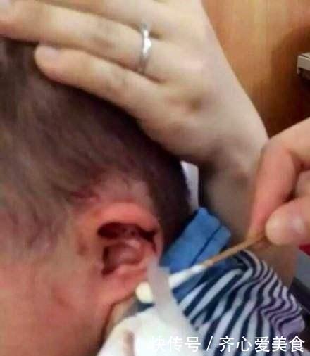 孩子|7岁男童总说耳朵痒,妈妈用手电筒一看,身上的鸡皮疙瘩都起来了