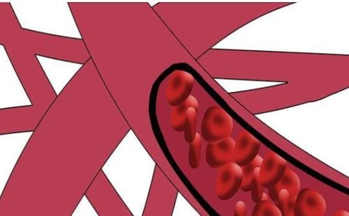 医生|血脂升高，身体早有告知！医生：警示信号若同时出现，该降脂了