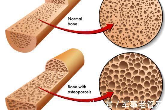 错误|为什么每天喝牛奶,还出现骨质疏松?你可能犯了5个错误!