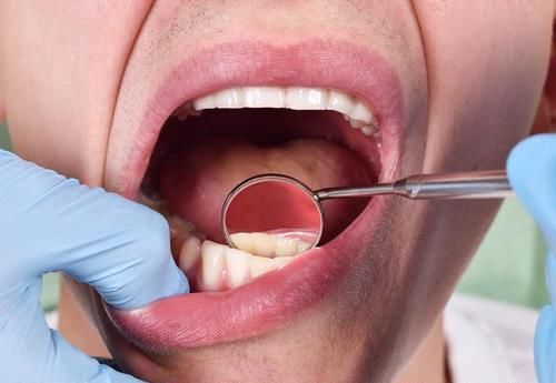 牙龈出血是小事 经常这样的话 可能和这5个原因有关 快资讯