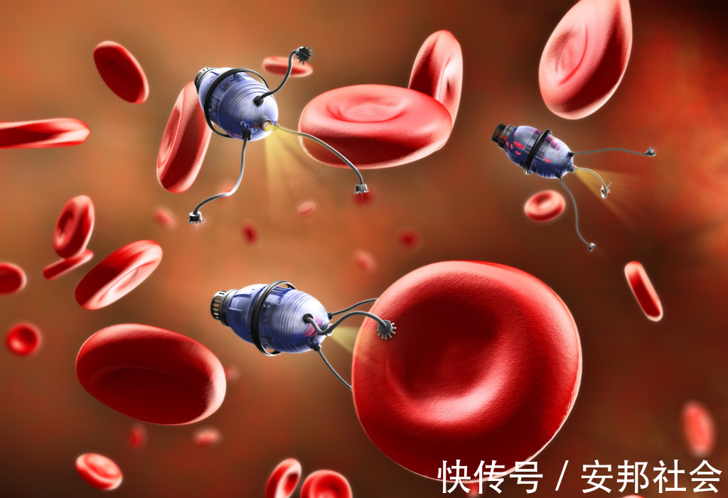 根治性|明明是肺癌早期做了根治性手术,不久就复发转移了,到底什么原因