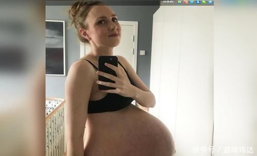 腹部|孕肚大说明怀多胎?这类“悬浮肚”不是喜反是忧,心疼遭罪孕妈
