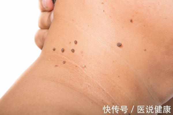 肝脏|男人中年后,身上有2处变大2处变硬,健康或出问题了,要重视!