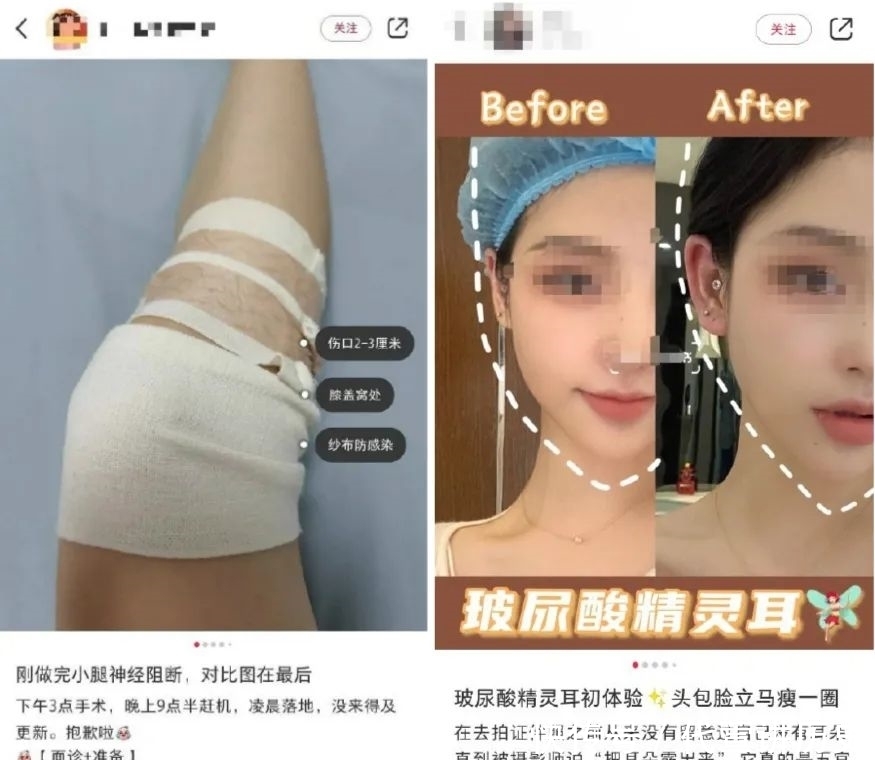 洗衣机|大洗衣机时代,整容变美真能逆天改命吗?