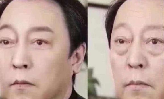 三阴交|人到中年,脸下垂!中医4招,迅速提升下垂脸,简简单单就变美!