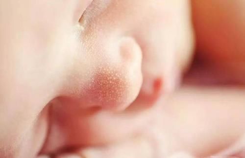 宝宝|宝宝身上的这些“奇怪现象”,根本不是病!别再带孩子往医院跑