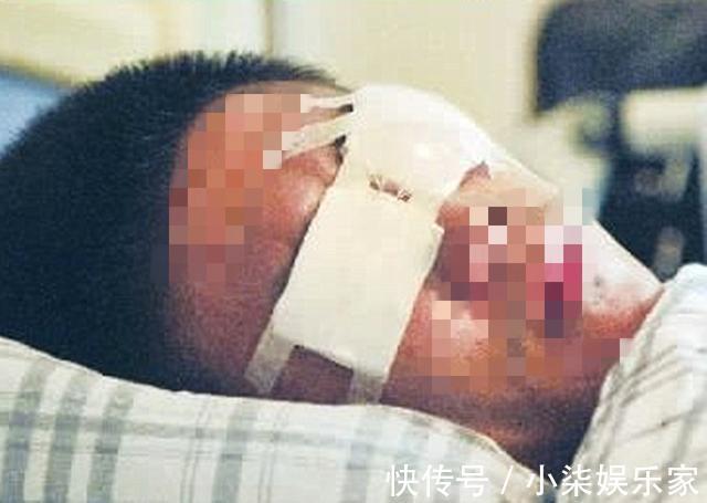 石灰|3岁男孩把石灰撒进眼睛，妈妈却不敢用水洗，事后医生骂无知