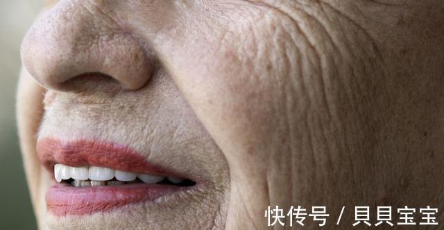 身体|提醒:身体出现6个变化,暗示血脂已经升高,很多人容易忽视