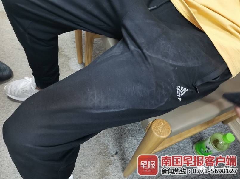 地板|验房师验房时遭人打伤报警，涉事者被传唤后称自己也需验伤