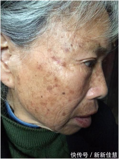 心脑血管|天然“降脂药”在身边,平时吃点,血管年轻10岁,高血脂不攻自破