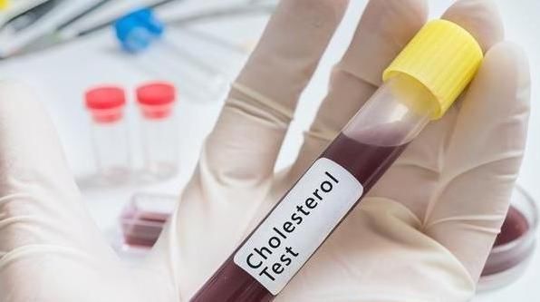 维生素c|高血脂多是“吃”出来的医生警告3种食物不戒掉，血脂不会降