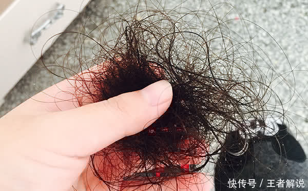 手术治疗|得了癌症后,同样都是选择化疗,为啥有人效果好,有人效果差?