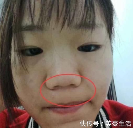 鼻子|最“毁鼻子”的3行为,学生党却成习惯,占一个异性缘就会归0哟!