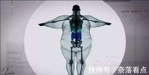 X光|“900斤”男子接受全身扫描，X光照片惊呆众人