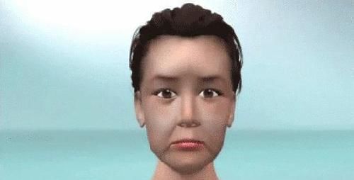 不到50岁就老成大妈？小拉皮术后6个月轻松实现逆生长！