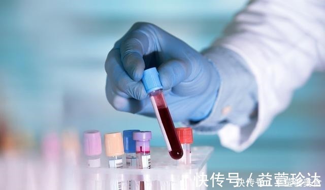 生存率|战胜癌症靠运气？肿瘤专家表示，抗癌成功的人都有这4大特点
