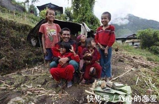 长相|9岁女孩因长相奇怪被称为“半脸怪物”,术后让人大开眼界