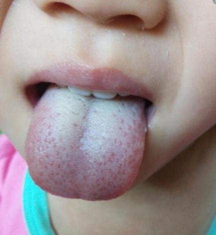 大宝|这5类食物容易伤脾胃,家长却经常给孩子吃,零食只是其中一类