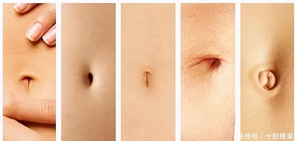 肚脐的黑泥不能清理,否则会进风、漏气、烂肠子?医生辟谣说清楚