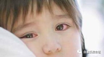 中医|自古中医就对白塞氏病有研究